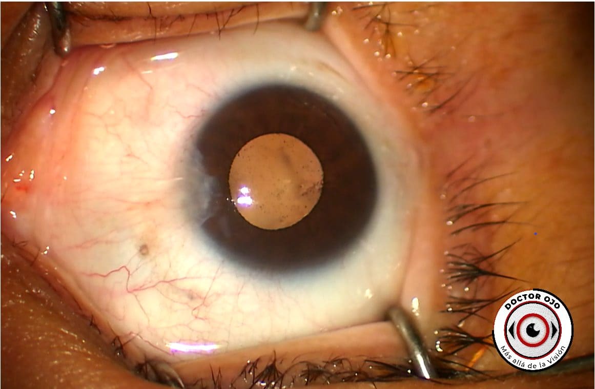 Ojo con